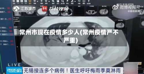 常州市现在疫情多少人(常州疫情严不严重)