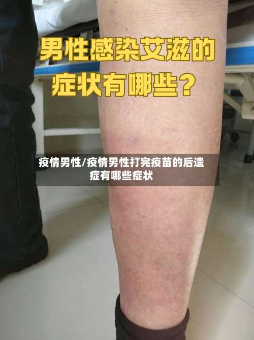 疫情男性/疫情男性打完疫苗的后遗症有哪些症状