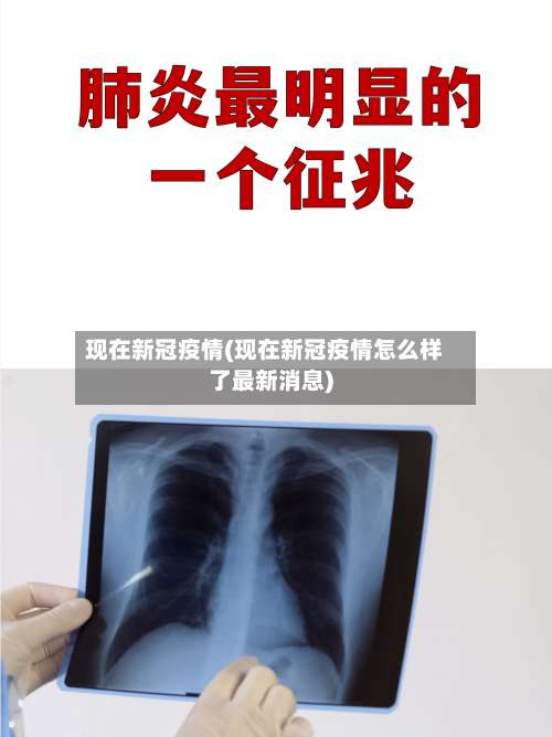 现在新冠疫情(现在新冠疫情怎么样了最新消息)-第2张图片