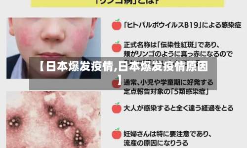 【日本爆发疫情,日本爆发疫情原因】