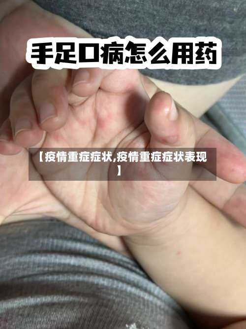 【疫情重症症状,疫情重症症状表现】