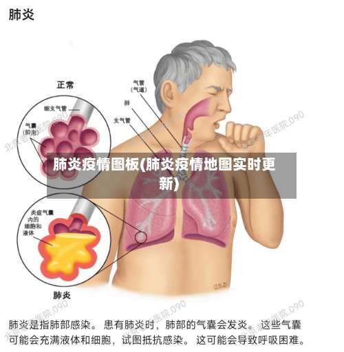 肺炎疫情图板(肺炎疫情地图实时更新)-第2张图片