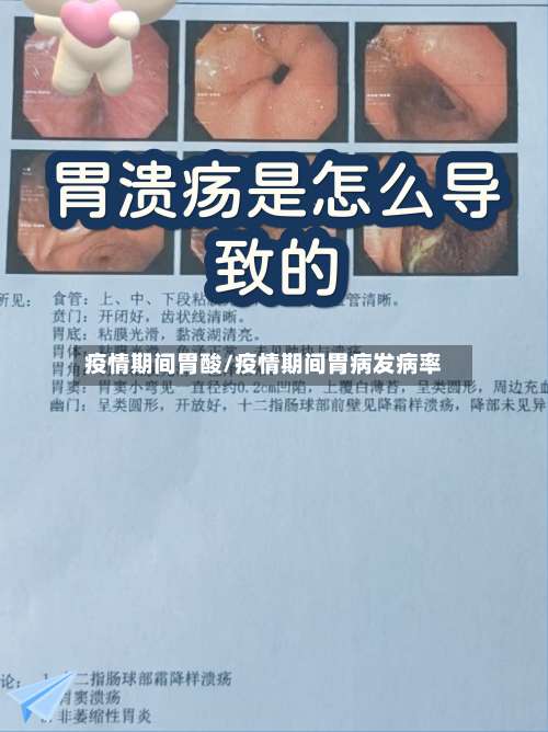疫情期间胃酸/疫情期间胃病发病率
